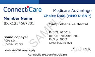 ID card - Choice HMO high-deductible - front